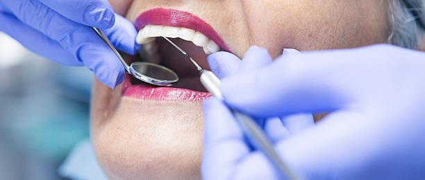 Best Broken or Chipped Tooth Repair in USA